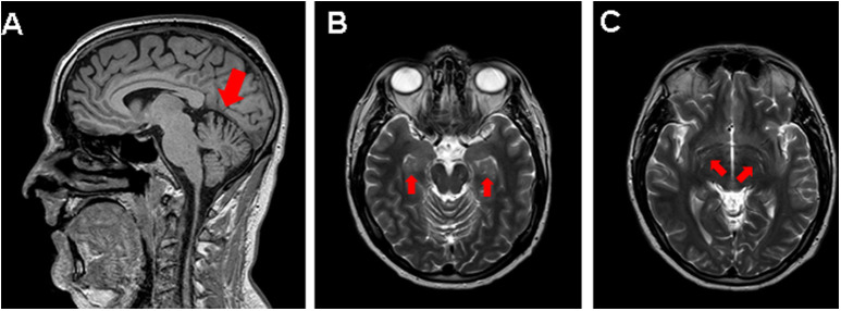 Fig. 2