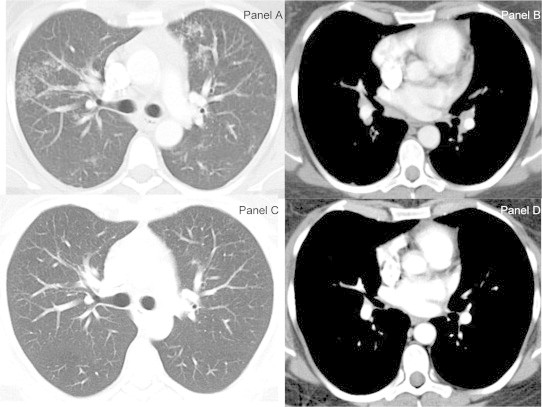 Fig. 1