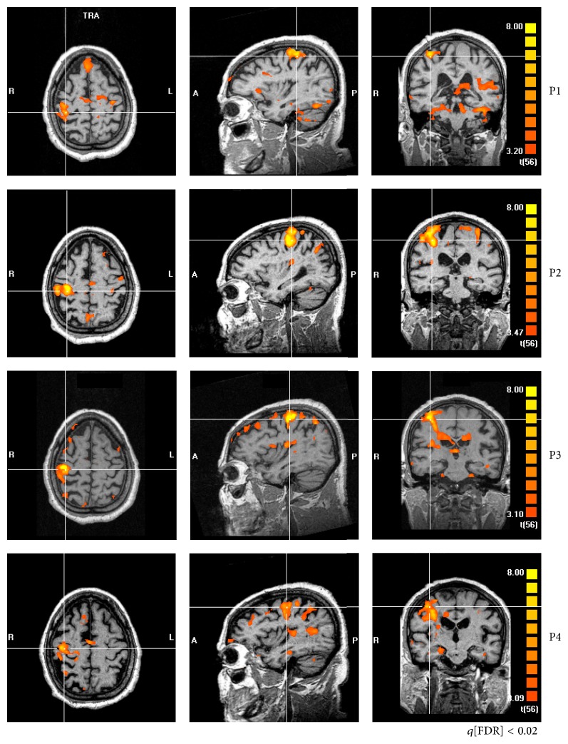 Figure 2