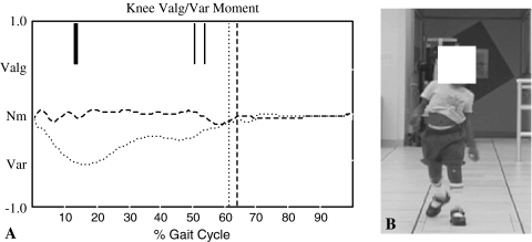 Fig. 4A–B