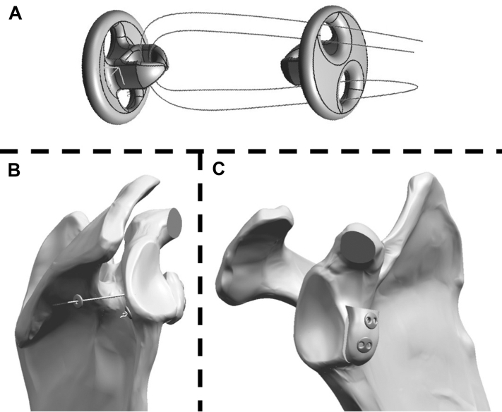 Figure 1