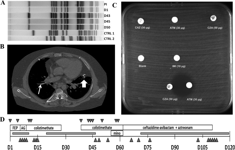 FIG 1