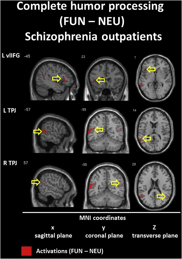 Fig. 9