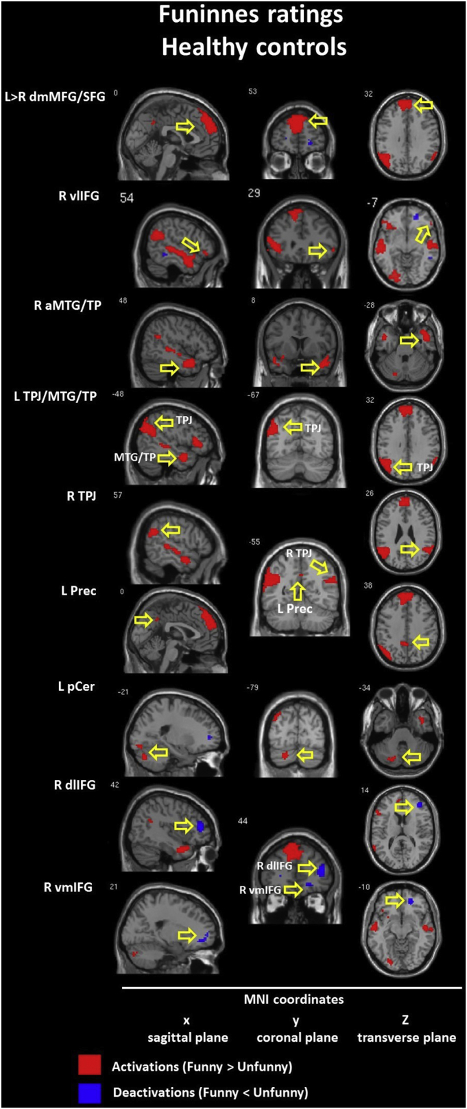 Fig. 12