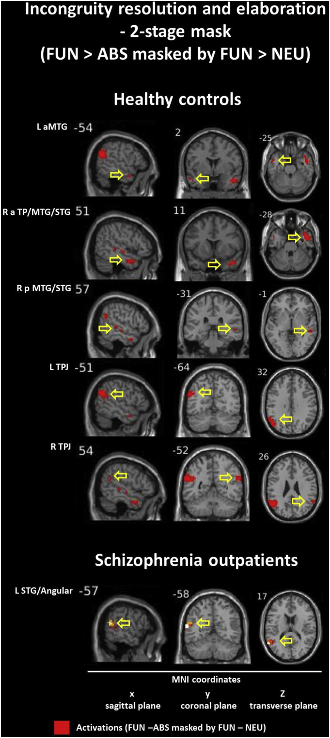 Fig. 14