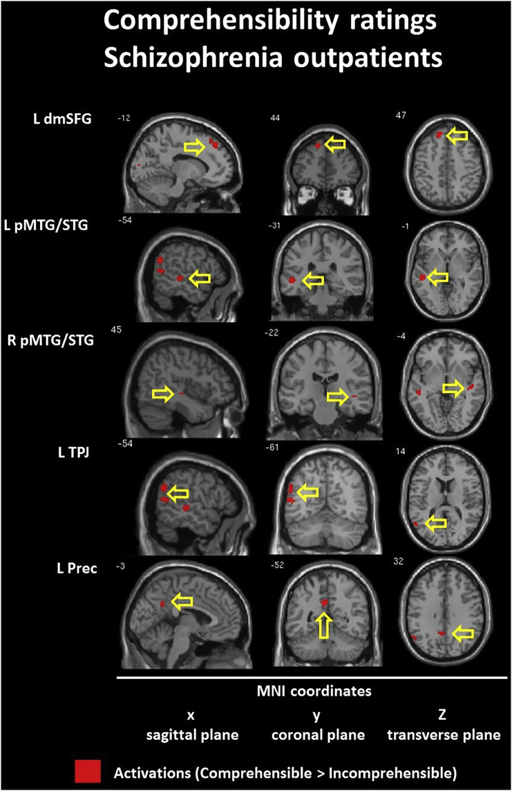 Fig. 11