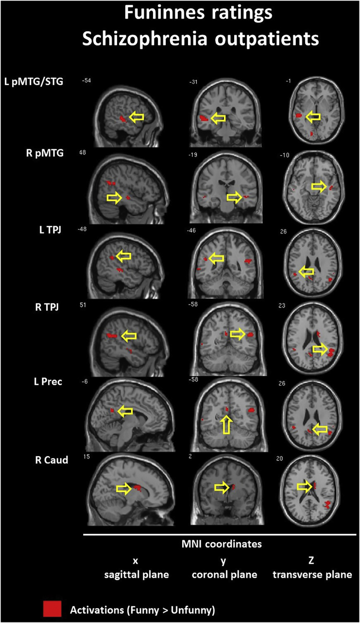 Fig. 13