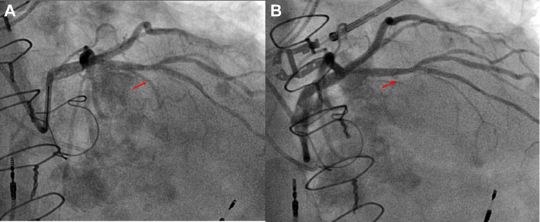 Figure 3