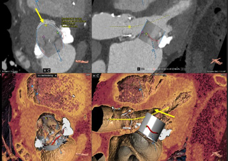 Figure 4