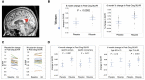 Figure 3 <b>Comparison of changes in FDG-PET in PC over 6 months.</b>