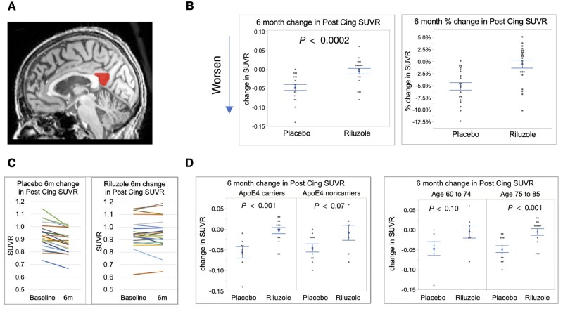 Figure 3 Comparison of changes in FDG-PET in PC over 6 months.