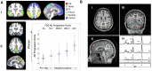 Figure 1<b> Neuroimaging measures for the study: FDG-PET (<i>left</i>) and <sup>1</sup>H MRS (<i>right</i>).</b>