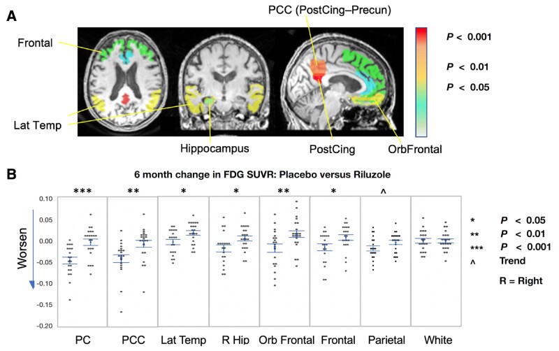 Figure 4 Comparison of changes in FDG-PET in prespecified regions of interest over 6 months.