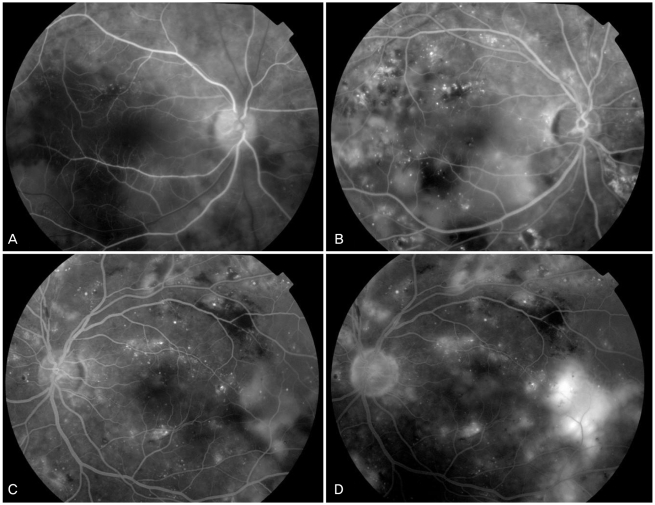 Fig. 2