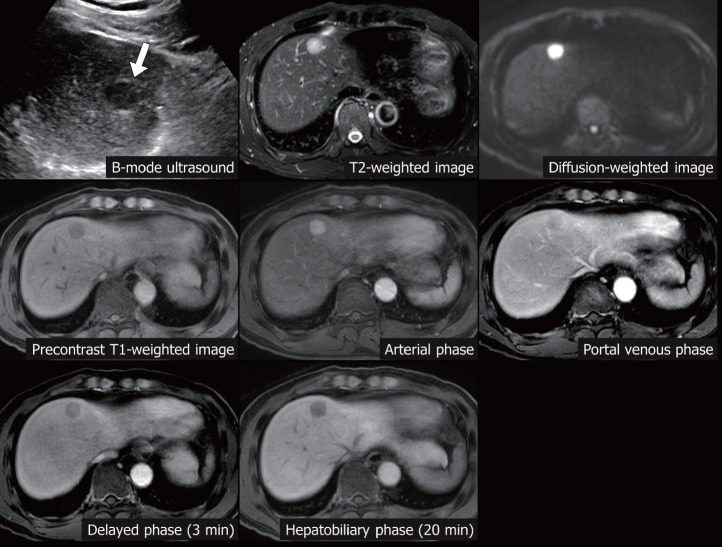 Figure 4.