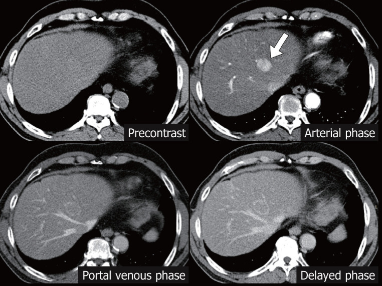 Figure 6.