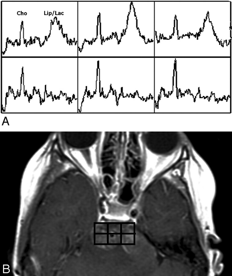 Fig 3.