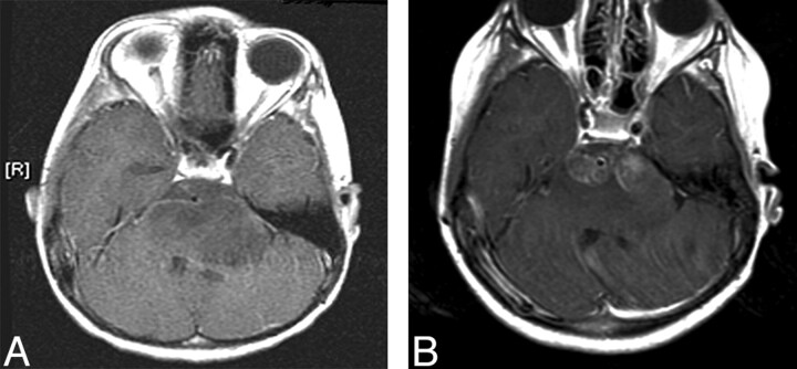 Fig 1.