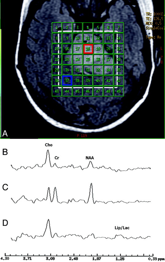 Fig 2.