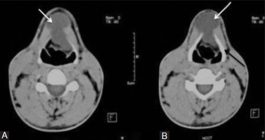 Figure 2 (A, B)