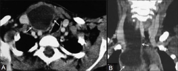 Figure 11(A, B)