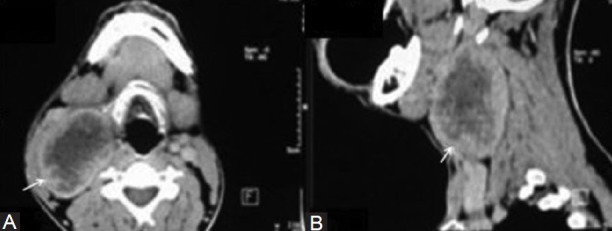 Figure 16(A, B)