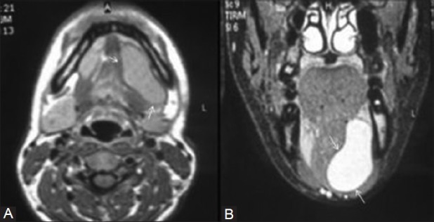 Figure 14(A, B)