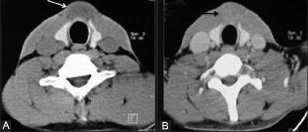 Figure 3 (A, B)