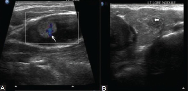 Figure 15(A, B)