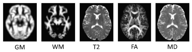 Fig. 1