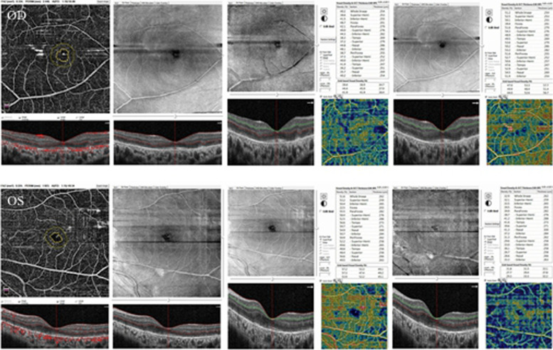 Fig. 4