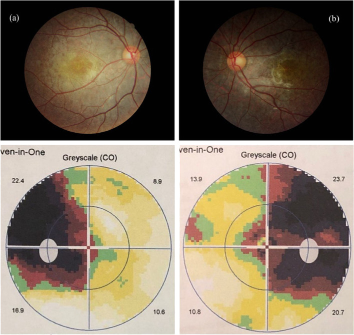 Fig. 2