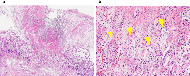 Fig. 4