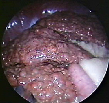 Figure 61-19