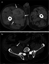 Fig. 10