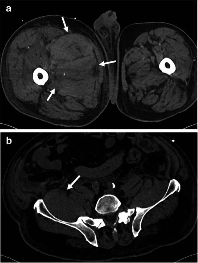 Fig. 10