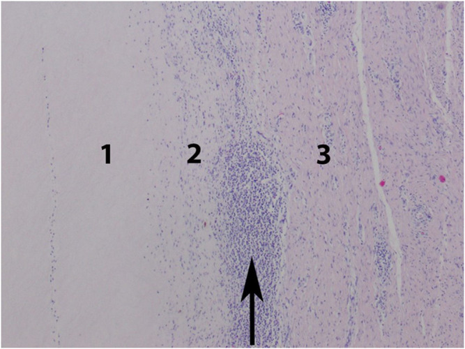 FIGURE 3