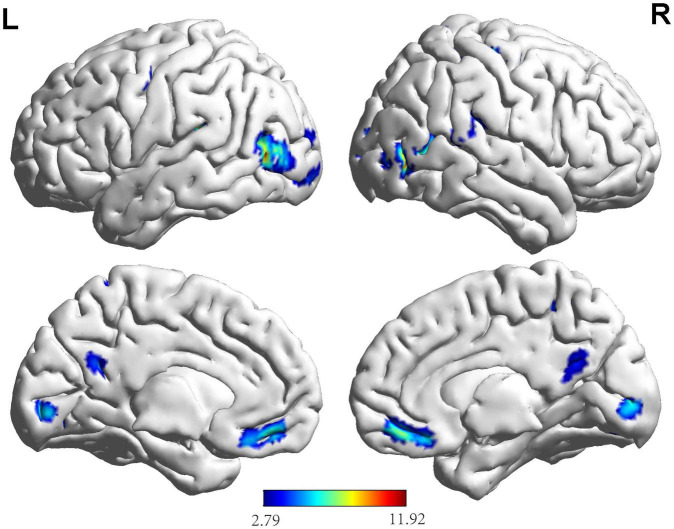 FIGURE 3
