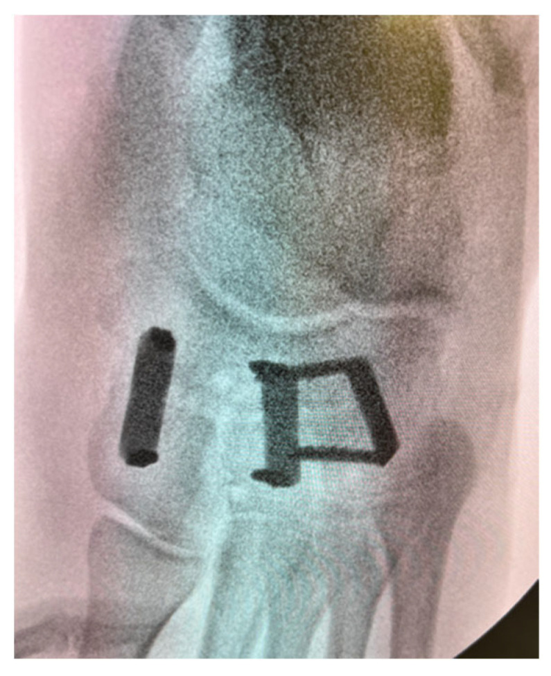 Figure 6