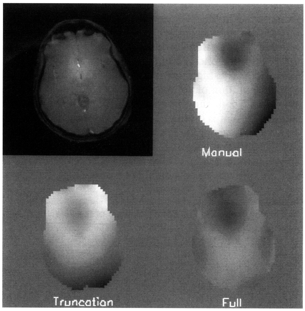 FIG. 4