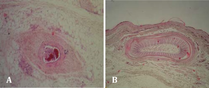 Fig.4