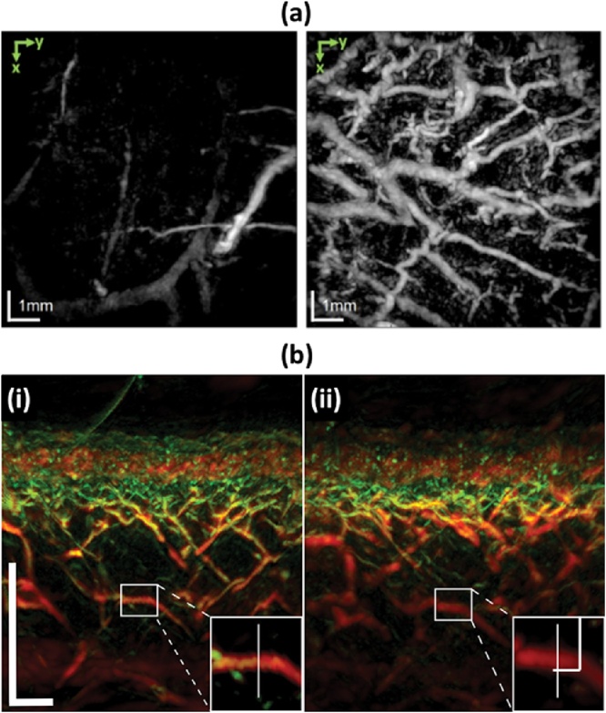 Fig. 15