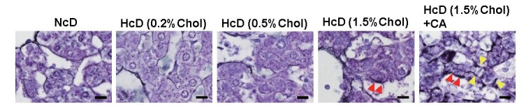 Fig.3. Representative images of Gömöri’s silver impregnation for perisinusoidal fibrosis