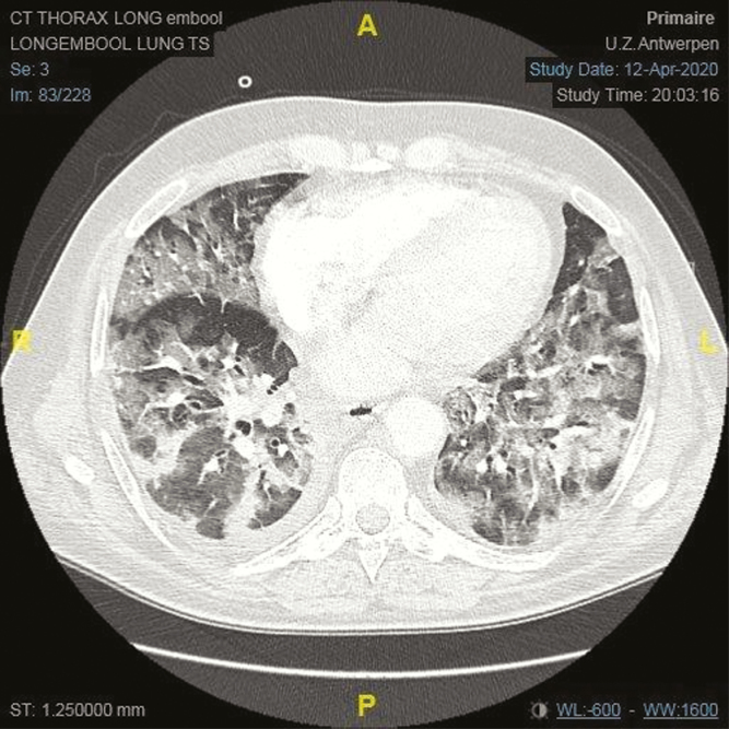 Figure 2.