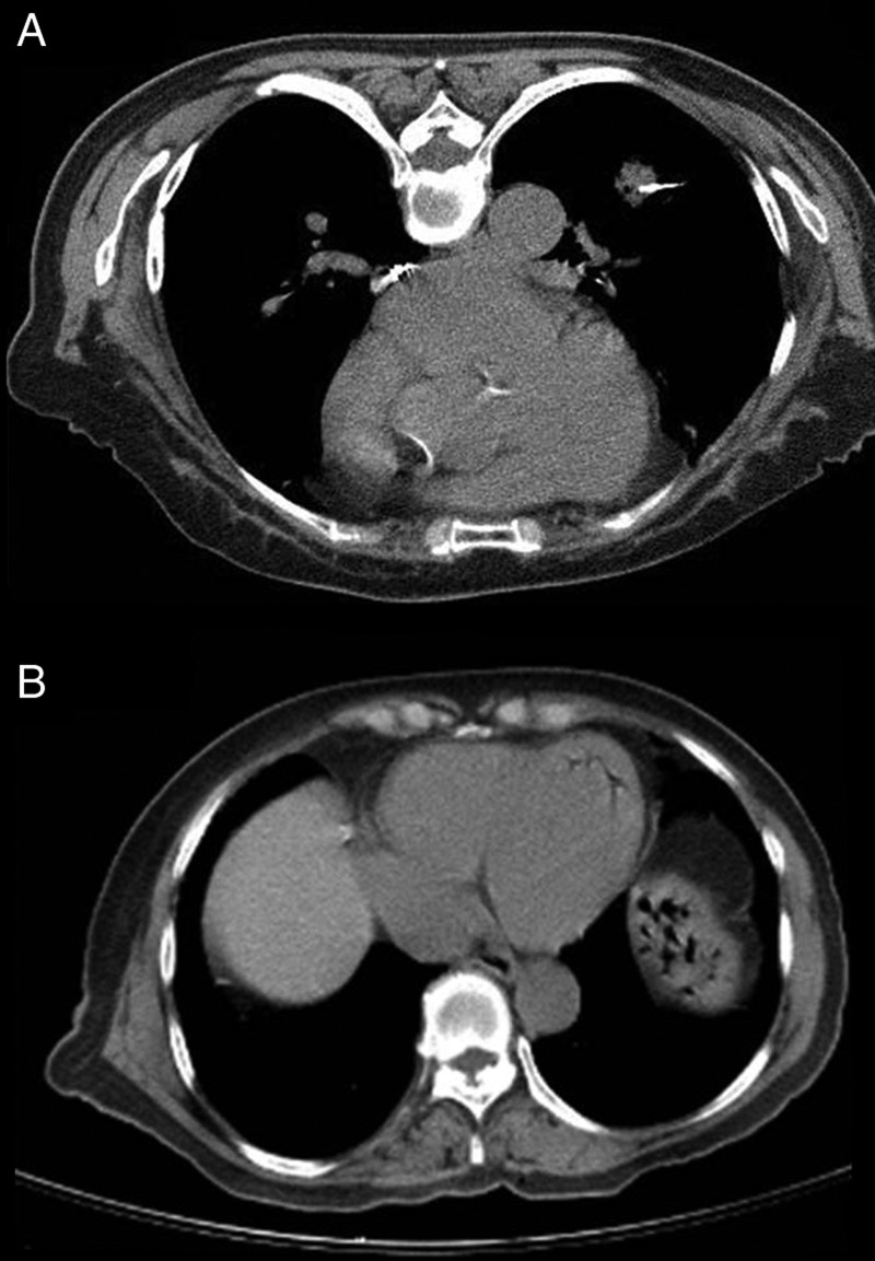 Figure 2: