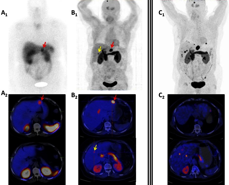 Fig. 2