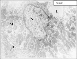 Figure 22