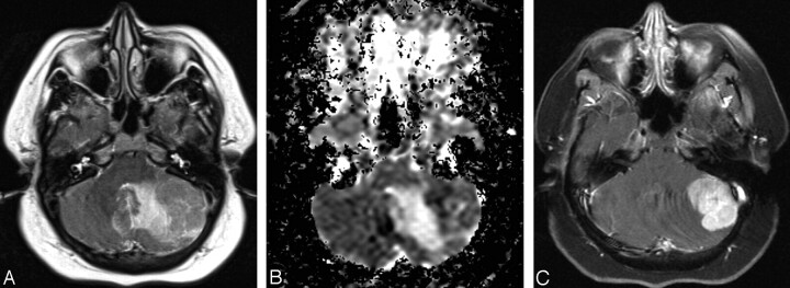 Fig 4.