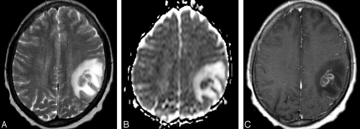 Fig 2.