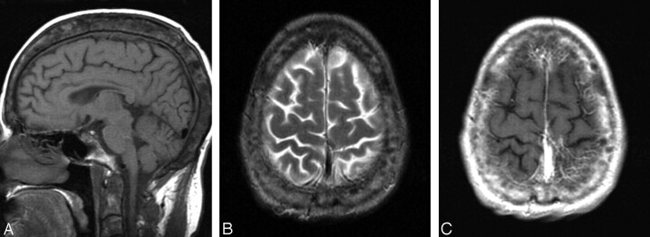 Fig 5.